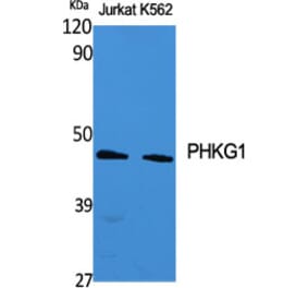 Western Blot - Anti-PHKG1 Antibody (C21177) - Antibodies.com