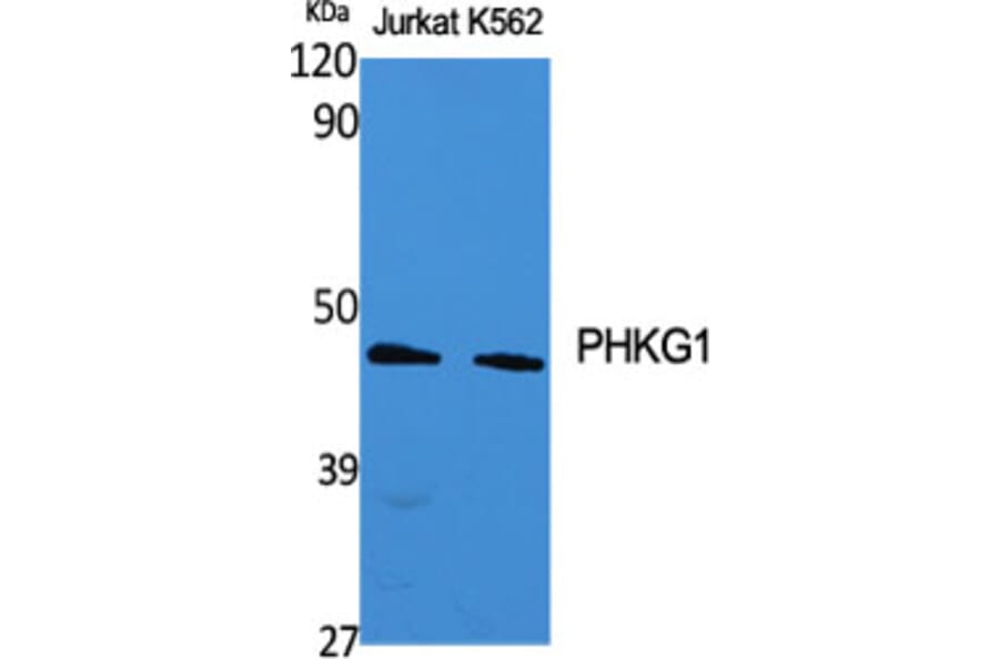 Western Blot - Anti-PHKG1 Antibody (C21177) - Antibodies.com