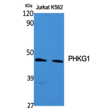 Western Blot - Anti-PHKG1 Antibody (C21177) - Antibodies.com