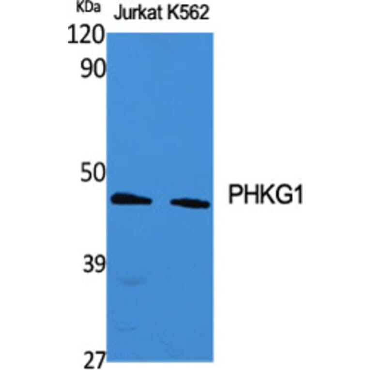 Western Blot - Anti-PHKG1 Antibody (C21177) - Antibodies.com