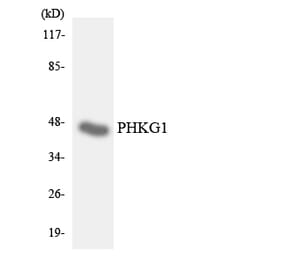 Western Blot - Anti-PHKG1 Antibody (R12-3324) - Antibodies.com