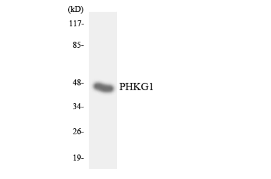 Western Blot - Anti-PHKG1 Antibody (R12-3324) - Antibodies.com
