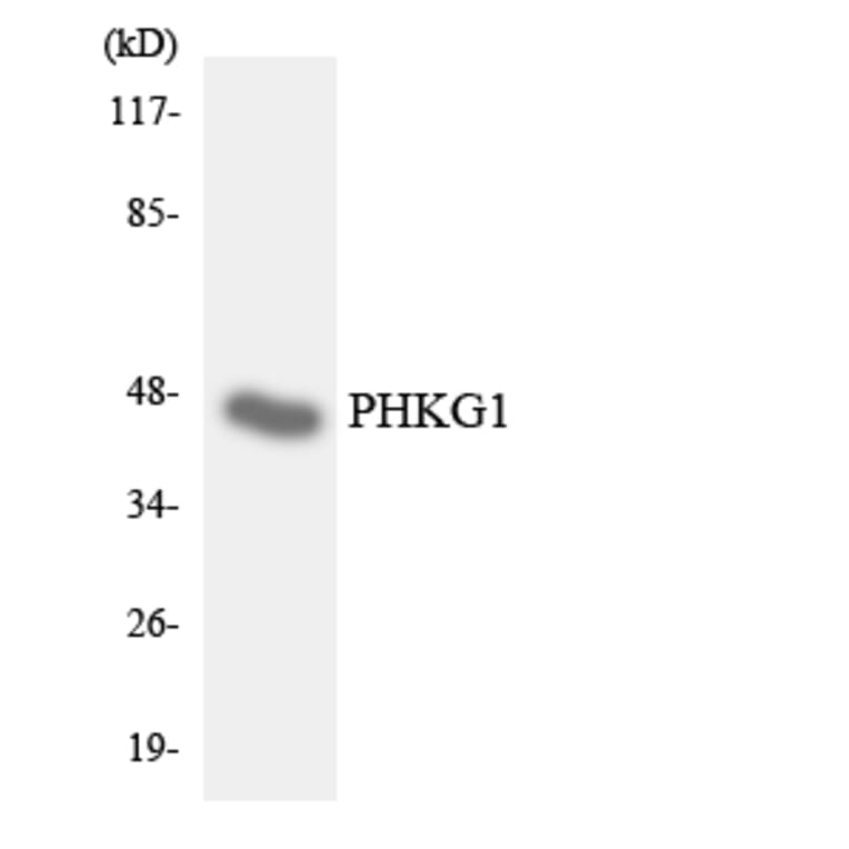 Western Blot - Anti-PHKG1 Antibody (R12-3324) - Antibodies.com