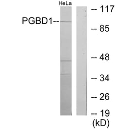 Western Blot - Anti-PGBD1 Antibody (C11505) - Antibodies.com