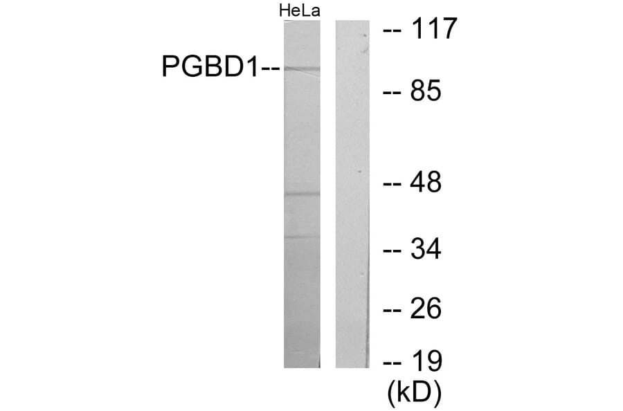 Western Blot - Anti-PGBD1 Antibody (C11505) - Antibodies.com