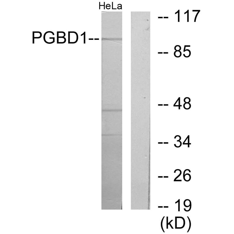 Western Blot - Anti-PGBD1 Antibody (C11505) - Antibodies.com