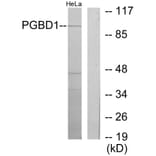 Western Blot - Anti-PGBD1 Antibody (C11505) - Antibodies.com