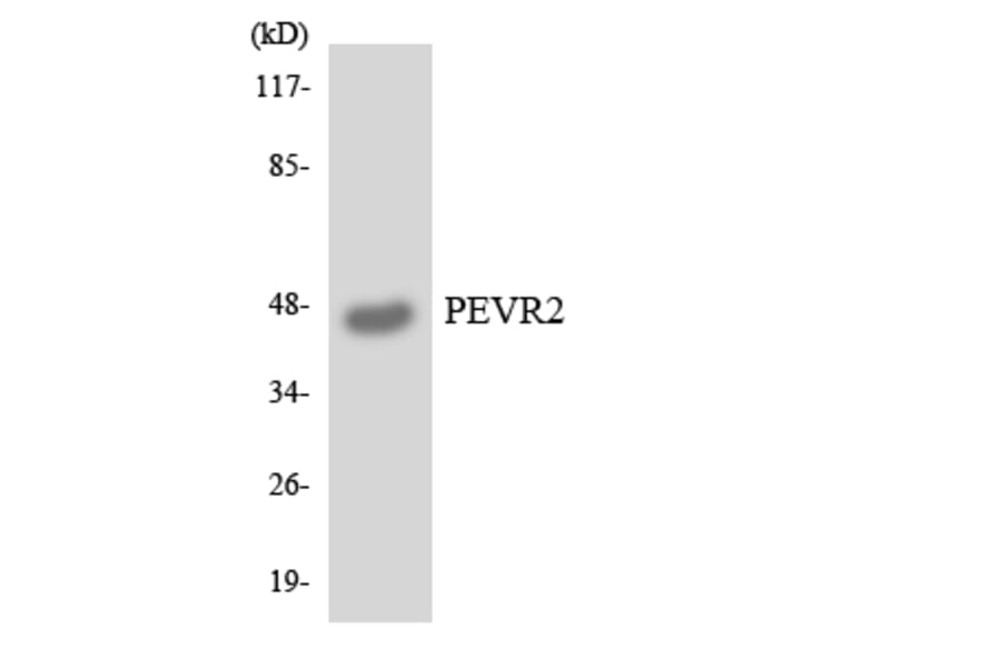Western Blot - Anti-PEVR2 Antibody (R12-3319) - Antibodies.com