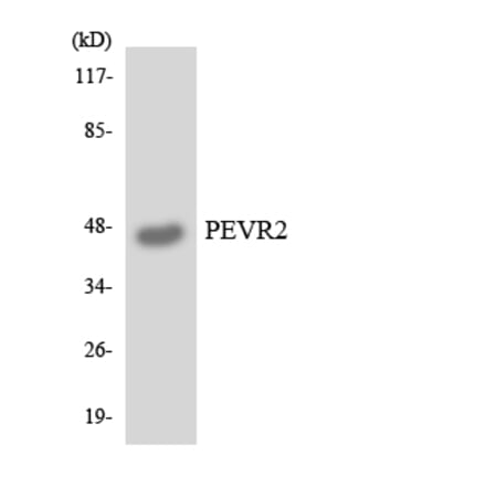 Western Blot - Anti-PEVR2 Antibody (R12-3319) - Antibodies.com