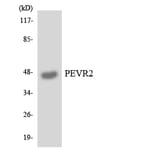 Western Blot - Anti-PEVR2 Antibody (R12-3319) - Antibodies.com