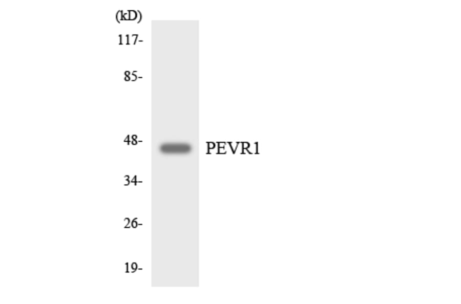 Western Blot - Anti-PEVR1 Antibody (R12-3318) - Antibodies.com