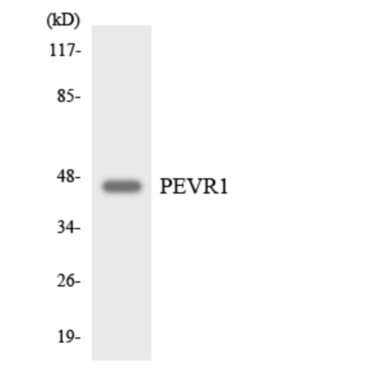 Western Blot - Anti-PEVR1 Antibody (R12-3318) - Antibodies.com