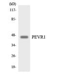 Western Blot - Anti-PEVR1 Antibody (R12-3318) - Antibodies.com