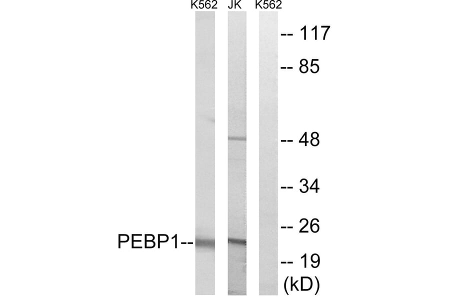 Western Blot - Anti-PEBP1 Antibody (C17661) - Antibodies.com