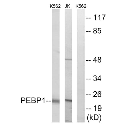 Western Blot - Anti-PEBP1 Antibody (C17661) - Antibodies.com