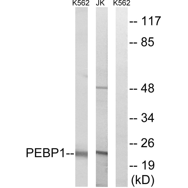 Western Blot - Anti-PEBP1 Antibody (C17661) - Antibodies.com