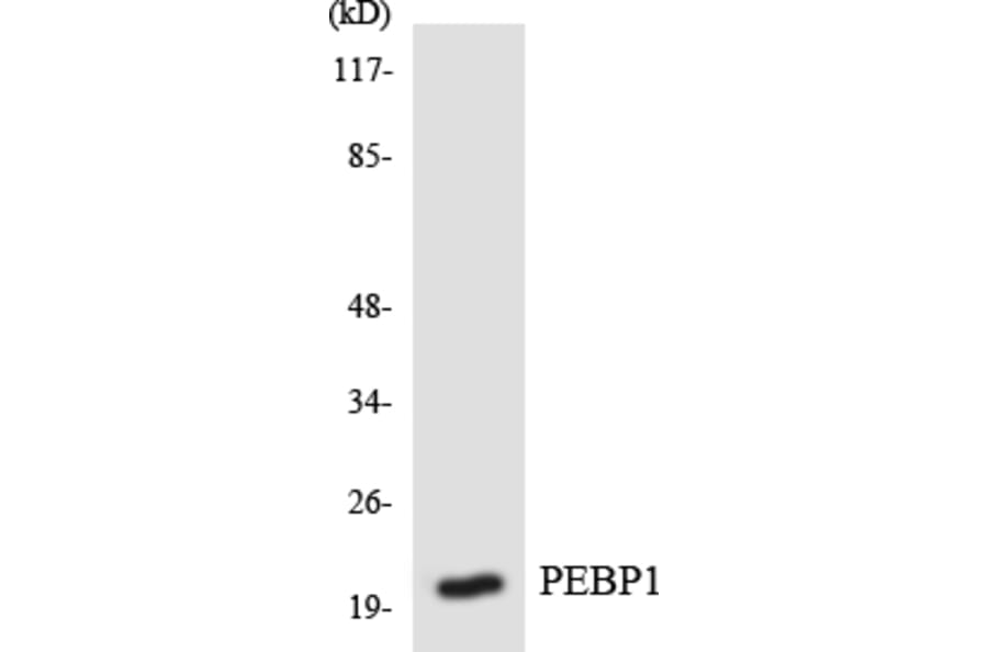 Western Blot - Anti-PEBP1 Antibody (R12-3314) - Antibodies.com