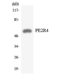Western Blot - Anti-PE2R4 Antibody (R12-3313) - Antibodies.com