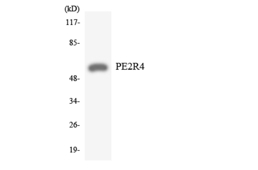 Western Blot - Anti-PE2R4 Antibody (R12-3313) - Antibodies.com