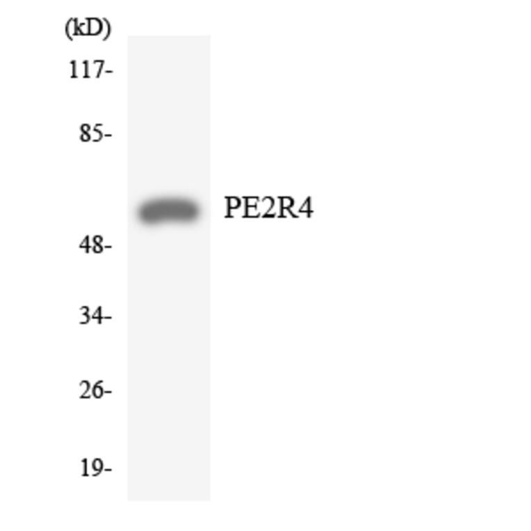 Western Blot - Anti-PE2R4 Antibody (R12-3313) - Antibodies.com