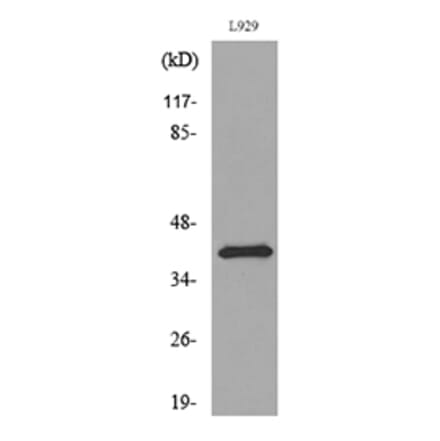 Western Blot - Anti-PDGFD Antibody (C30619) - Antibodies.com