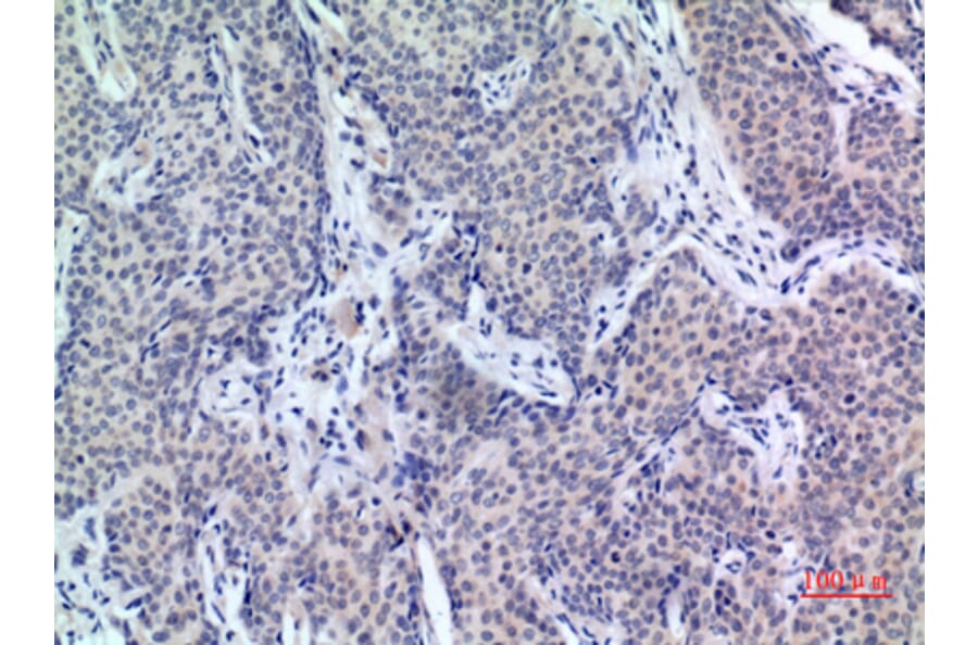 Immunohistochemistry - Anti-PDGFD Antibody (C30619) - Antibodies.com