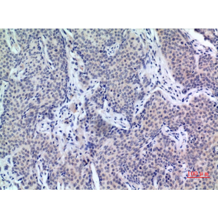 Immunohistochemistry - Anti-PDGFD Antibody (C30619) - Antibodies.com