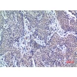 Immunohistochemistry - Anti-PDGFD Antibody (C30619) - Antibodies.com