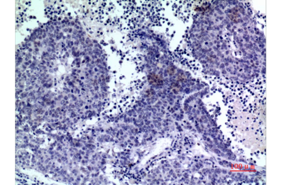 Immunohistochemistry - Anti-PDGFD Antibody (C30619) - Antibodies.com