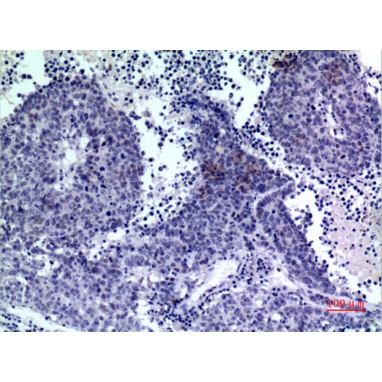 Immunohistochemistry - Anti-PDGFD Antibody (C30619) - Antibodies.com
