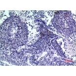 Immunohistochemistry - Anti-PDGFD Antibody (C30619) - Antibodies.com