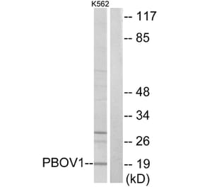 Western Blot - Anti-PBOV1 Antibody (C11669) - Antibodies.com