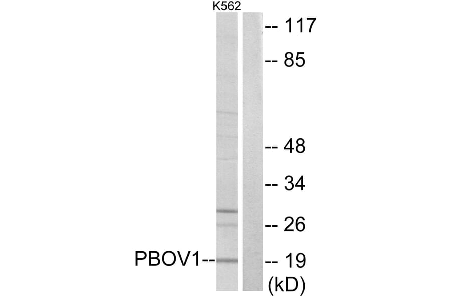 Western Blot - Anti-PBOV1 Antibody (C11669) - Antibodies.com