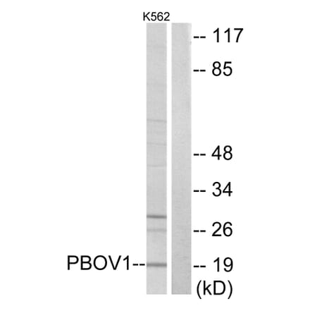 Western Blot - Anti-PBOV1 Antibody (C11669) - Antibodies.com