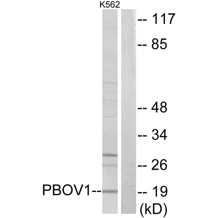 Western Blot - Anti-PBOV1 Antibody (C11669) - Antibodies.com