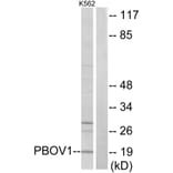 Western Blot - Anti-PBOV1 Antibody (C11669) - Antibodies.com