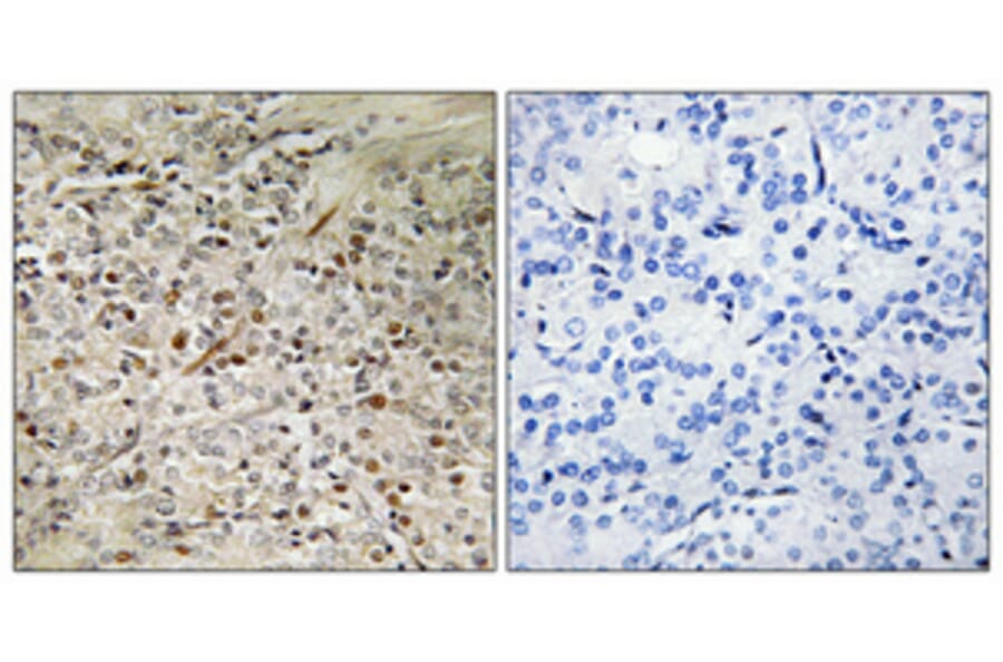 Immunohistochemistry - Anti-PBOV1 Antibody (C11669) - Antibodies.com