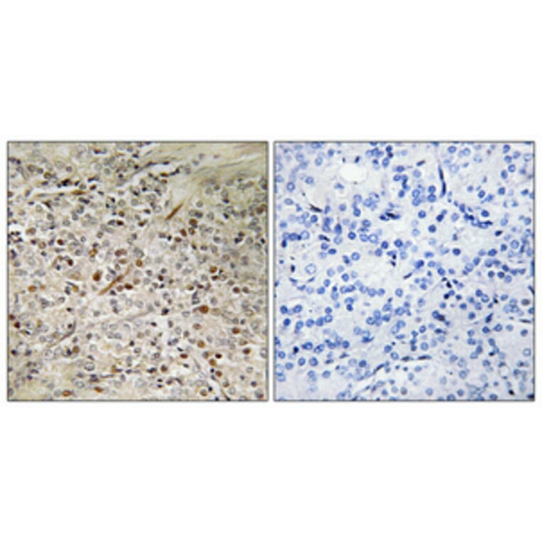 Immunohistochemistry - Anti-PBOV1 Antibody (C11669) - Antibodies.com