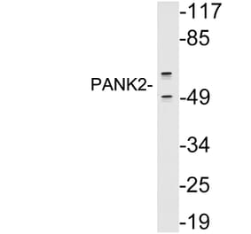 Western Blot - Anti-PANK2 Antibody (R12-2290) - Antibodies.com