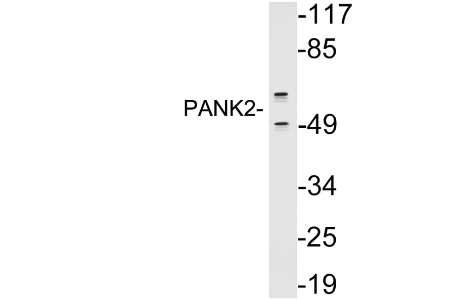 Western Blot - Anti-PANK2 Antibody (R12-2290) - Antibodies.com