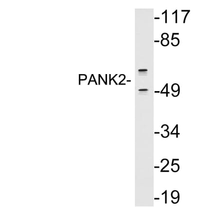 Western Blot - Anti-PANK2 Antibody (R12-2290) - Antibodies.com