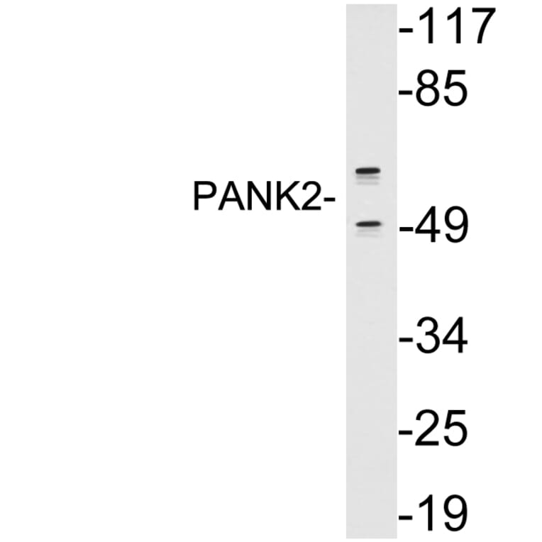 Western Blot - Anti-PANK2 Antibody (R12-2290) - Antibodies.com