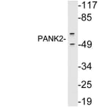Western Blot - Anti-PANK2 Antibody (R12-2290) - Antibodies.com