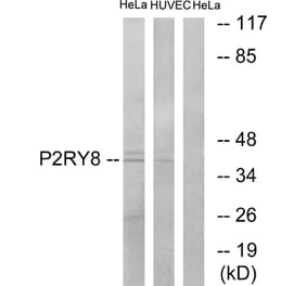 Western Blot - Anti-P2RY8 Antibody (G711) - Antibodies.com