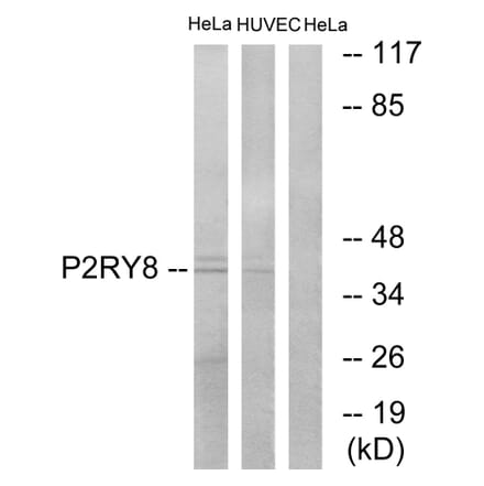 Western Blot - Anti-P2RY8 Antibody (G711) - Antibodies.com