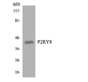 Western Blot - Anti-P2RY8 Antibody (R12-3282) - Antibodies.com
