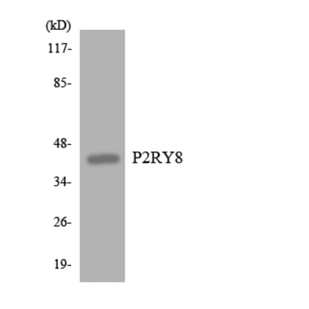 Western Blot - Anti-P2RY8 Antibody (R12-3282) - Antibodies.com