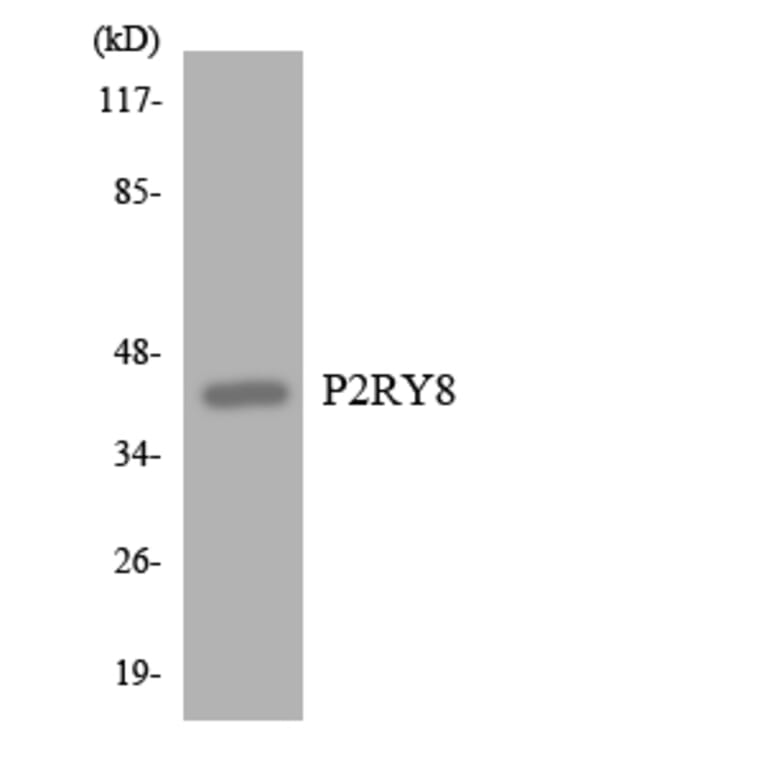 Western Blot - Anti-P2RY8 Antibody (R12-3282) - Antibodies.com