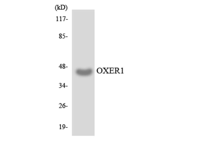 Western Blot - Anti-OXER1 Antibody (R12-3278) - Antibodies.com
