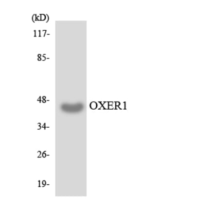 Western Blot - Anti-OXER1 Antibody (R12-3278) - Antibodies.com